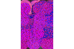 Flitry fialové fuchsie laser rovné 20 mm