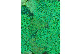 Flitry zelené laser rovné 20 mm